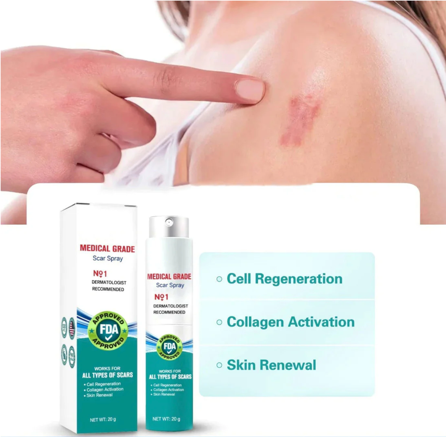 Cicacell™ – Tratamiento de mejora de cicatrices y estrías